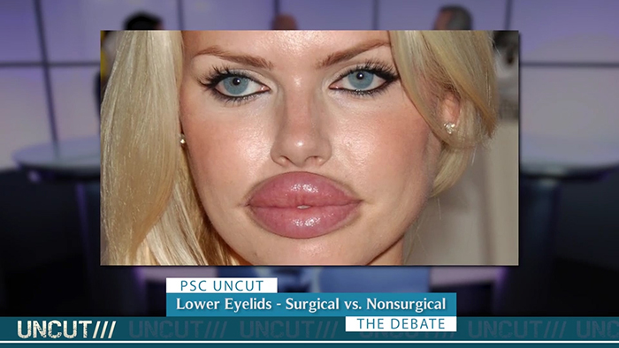 botched-plastic-surgery-and-revision.01.jpg