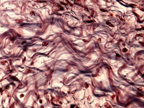 collagen under the microscope