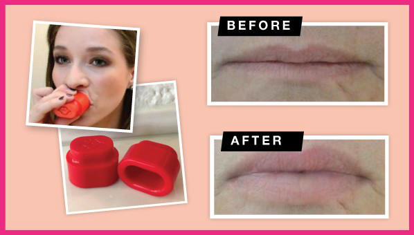 lipplumper.jpg