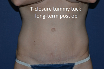 tcloseearly.jpg