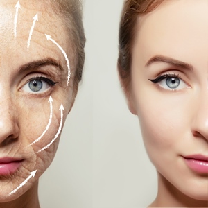 Move over, anti-aging: de-aging” is where it’s at