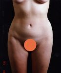 after liposuction front view male patient case 1444