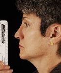 before rhinoplasty female patient left side view case 5204