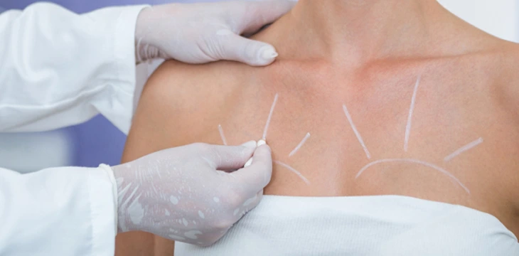 Breast Implant Removal