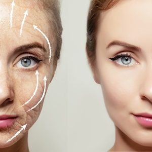 Phase-Plastic-Surgery-Blog-Anti-Aging7 Phase-Plastic-Surgery-Blog-Anti-Aging7
